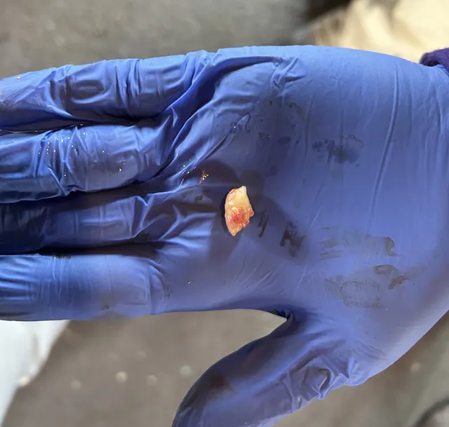 Wolf Tooth Extractions